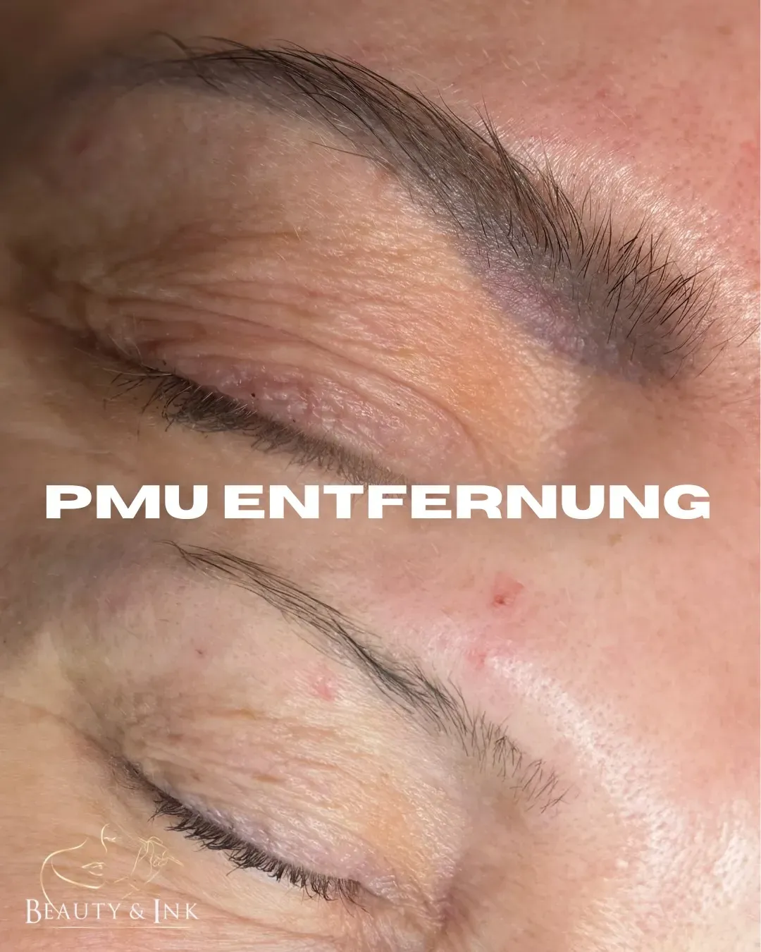 Vorher-Nachher-Vergleich einer PMU-Entfernung